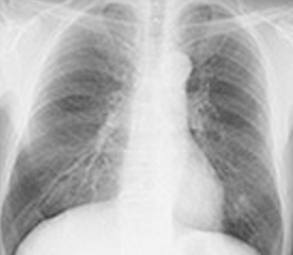 画像に alt 属性が指定されていません。ファイル名: xray-img02.jpg